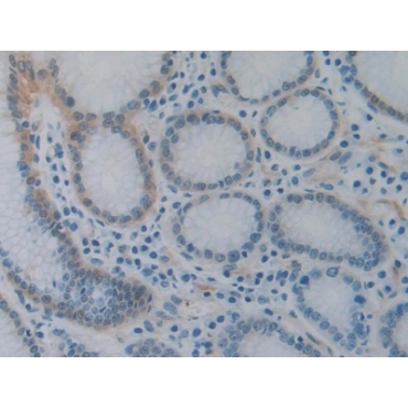 Heat Shock Protein 27 (Hsp27) Human Monoclonal Antibody
