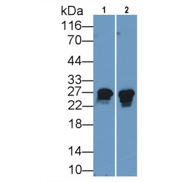 Heat Shock Protein 27 (Hsp27) Human Monoclonal Antibody