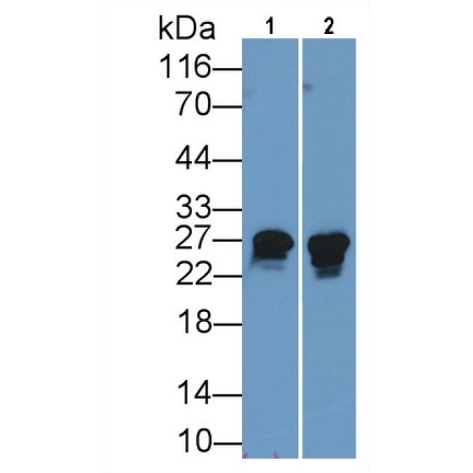 Heat Shock Protein 27 (Hsp27) Human Monoclonal Antibody