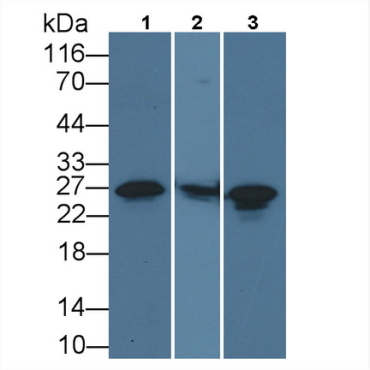 Heat Shock Protein 27 (Hsp27) Human Monoclonal Antibody