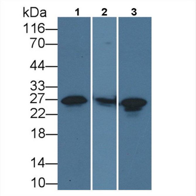 Heat Shock Protein 27 (Hsp27) Human Monoclonal Antibody