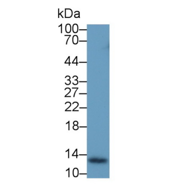 Thioredoxin (Trx) Human Monoclonal Antibody