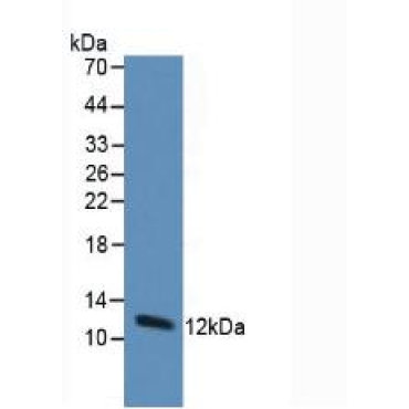 Thioredoxin (Trx) Human Monoclonal Antibody