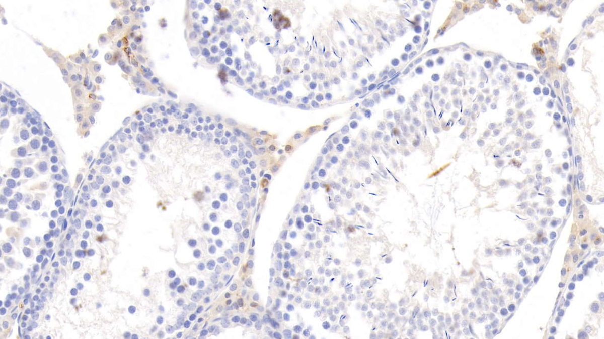 Apolipoprotein E (APOE) Rat Monoclonal Antibody