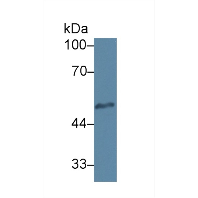 Heparanase (HPSE) Human Monoclonal Antibody