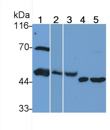 Heparanase (HPSE) Rat Monoclonal Antibody