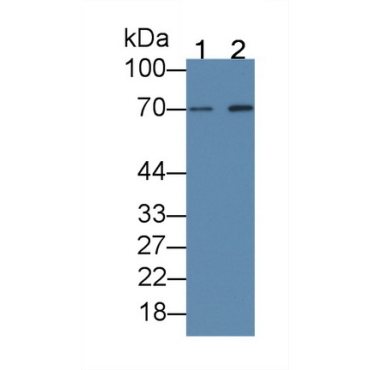 Beta-Site APP Cleaving Enzyme 1 (bACE1) Human Monoclonal Antibody