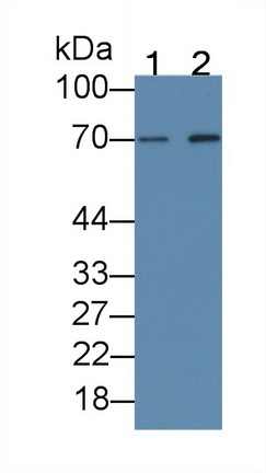 Beta-Site APP Cleaving Enzyme 1 (bACE1) Human Monoclonal Antibody