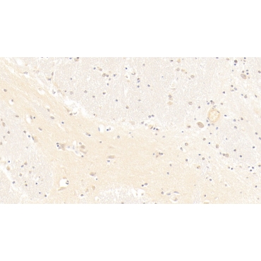 Beta-Site APP Cleaving Enzyme 1 (bACE1) Human Monoclonal Antibody