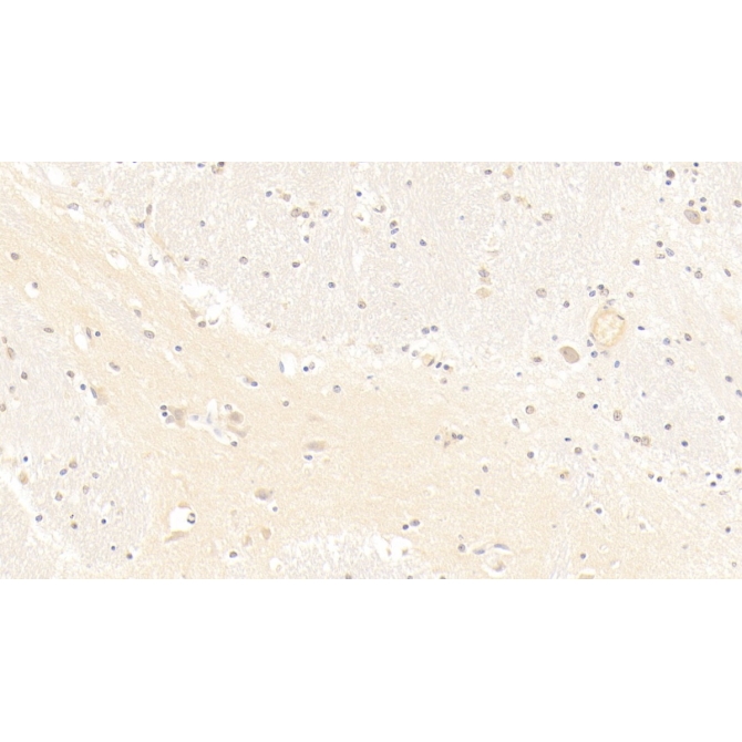 Beta-Site APP Cleaving Enzyme 1 (bACE1) Human Monoclonal Antibody