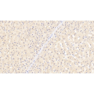 Beta-Site APP Cleaving Enzyme 1 (bACE1) Human Monoclonal Antibody