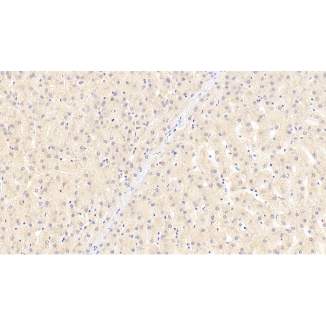 Beta-Site APP Cleaving Enzyme 1 (bACE1) Human Monoclonal Antibody