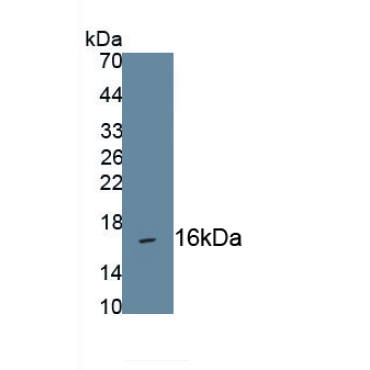 C-Type Natriuretic Peptide (CNP) Human Monoclonal Antibody