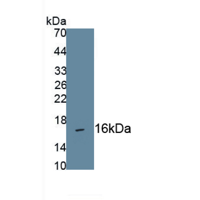 C-Type Natriuretic Peptide (CNP) Human Monoclonal Antibody
