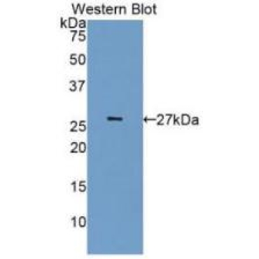 Cyclin Dependent Kinase 5 (CDK5) Human Monoclonal Antibody