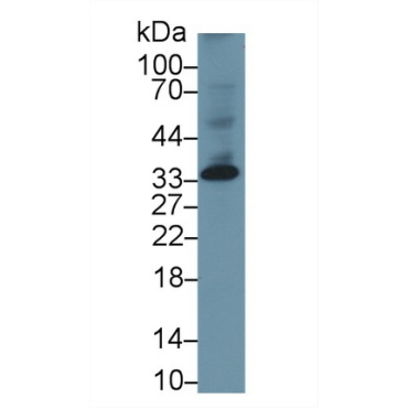 Dickkopf Related Protein 1 (DKK1) Human Monoclonal Antibody