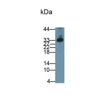Dickkopf Related Protein 1 (DKK1) Human Monoclonal Antibody
