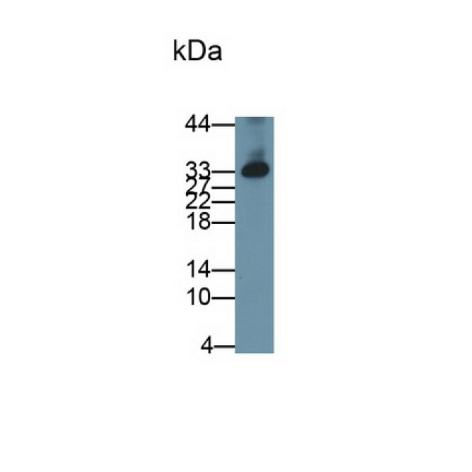 Dickkopf Related Protein 1 (DKK1) Human Monoclonal Antibody
