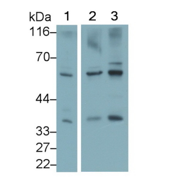 Dickkopf Related Protein 1 (DKK1) Human Monoclonal Antibody