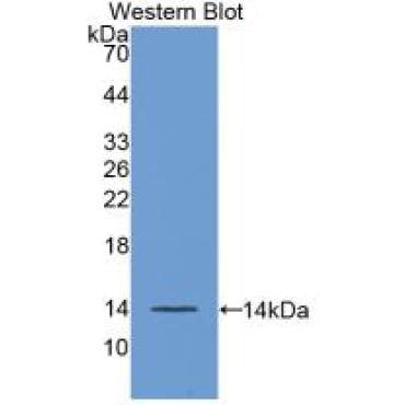 Fibroblast Growth Factor 23 (FGF23) Human Monoclonal Antibody