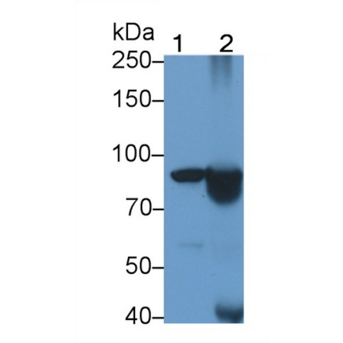 Complement Receptor 2 (CD21) Human Monoclonal Antibody