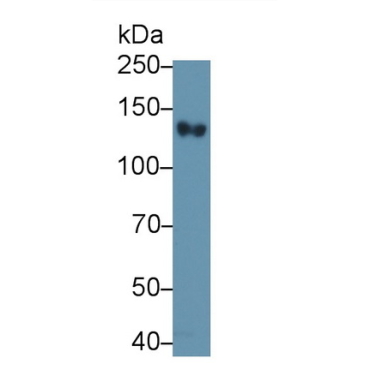 Complement Receptor 2 (CD21) Human Monoclonal Antibody
