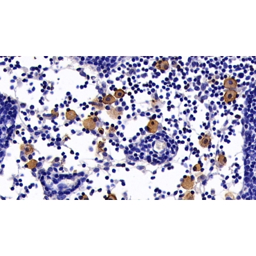 Complement Receptor 2 (CD21) Human Monoclonal Antibody