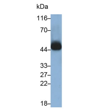 Cluster Of Differentiation 38 (CD38) Human Monoclonal Antibody