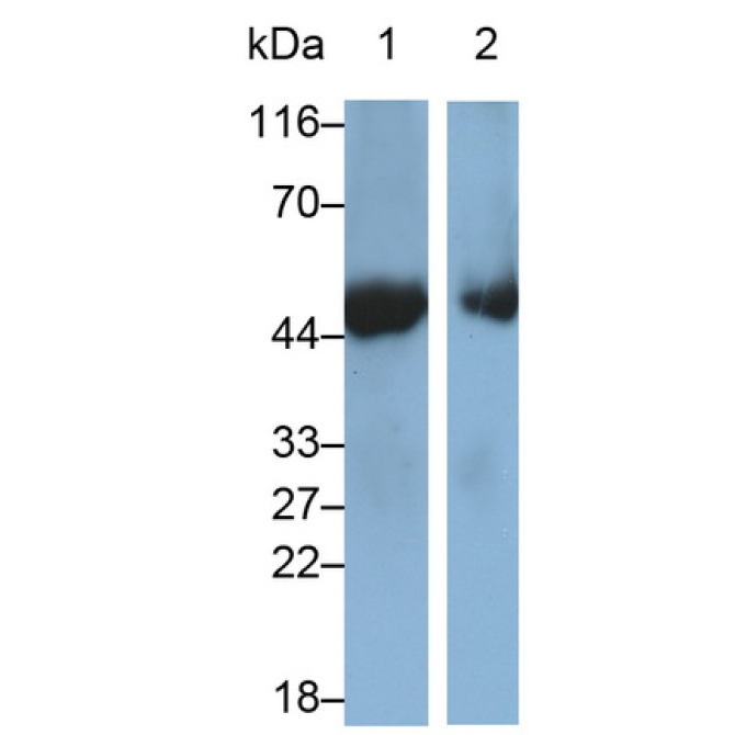 Cluster Of Differentiation 38 (CD38) Human Monoclonal Antibody