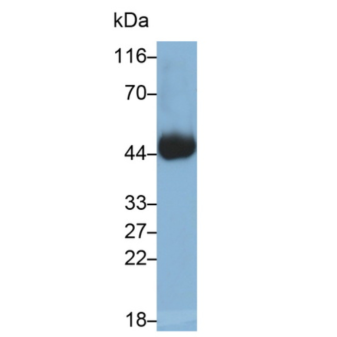 Cluster Of Differentiation 38 (CD38) Human Monoclonal Antibody