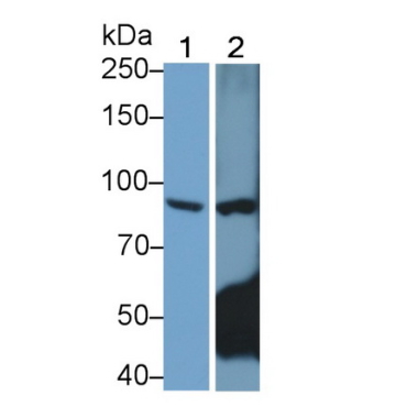 Toll Like Receptor 4 (TLR4) Human Monoclonal Antibody