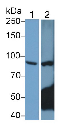 Toll Like Receptor 4 (TLR4) Human Monoclonal Antibody