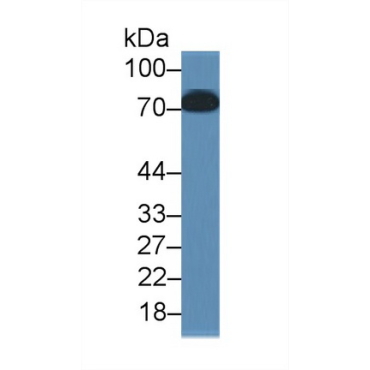 Toll Like Receptor 4 (TLR4) Human Monoclonal Antibody