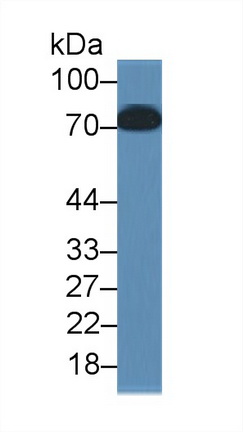 Toll Like Receptor 4 (TLR4) Human Monoclonal Antibody