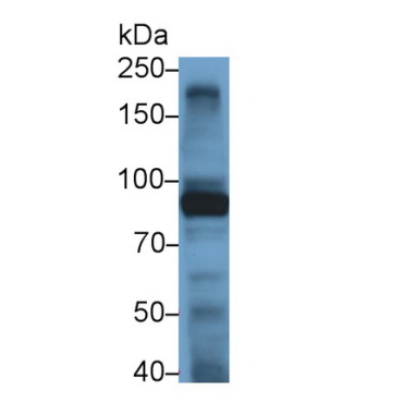 Toll Like Receptor 4 (TLR4) Human Monoclonal Antibody