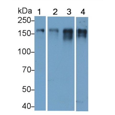 Epidermal Growth Factor Receptor (EGFR) Human Monoclonal Antibody