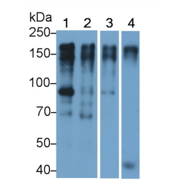 Epidermal Growth Factor Receptor (EGFR) Human Monoclonal Antibody