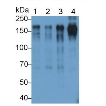 Epidermal Growth Factor Receptor (EGFR) Human Monoclonal Antibody