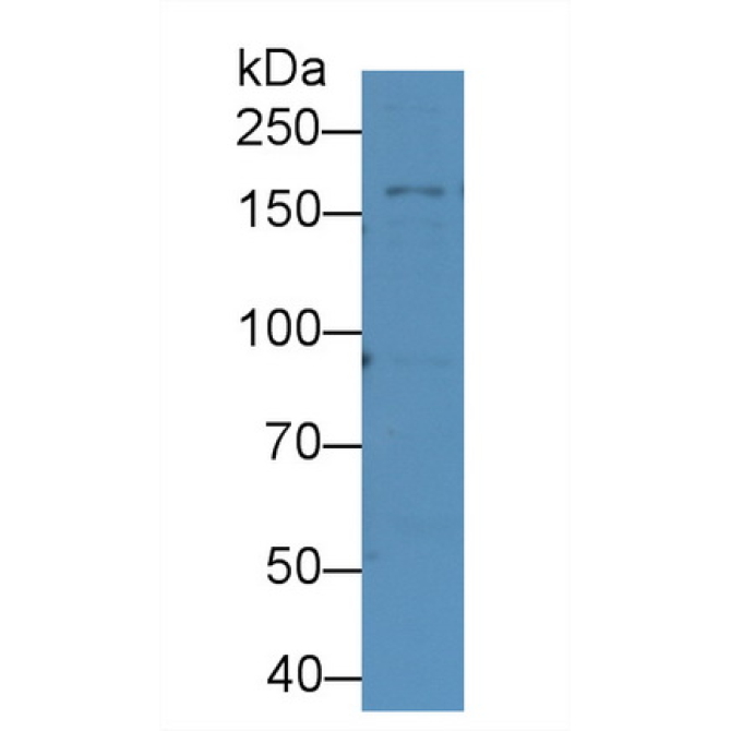 Complement C3 Convertase (C3 Convertase) Human Monoclonal Antibody