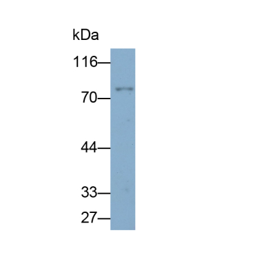 Forkhead Box Protein P1 (FOXP1) Human Monoclonal Antibody