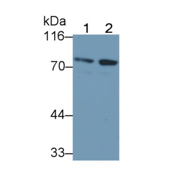 Forkhead Box Protein P1 (FOXP1) Human Monoclonal Antibody