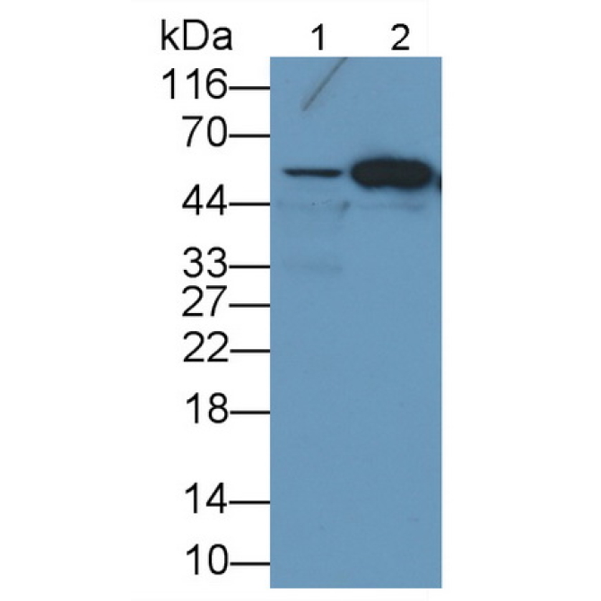 Forkhead Box Protein P1 (FOXP1) Human Monoclonal Antibody