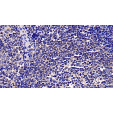Chemokine C-X-C-Motif Ligand 16 (CXCL16) Human Monoclonal Antibody