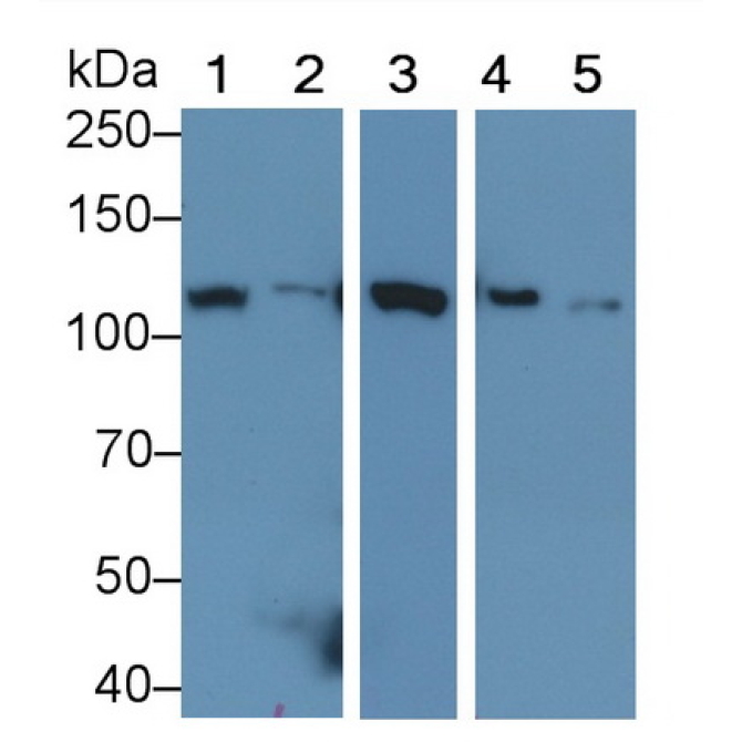Hexokinase 1 (HK1) Human Monoclonal Antibody
