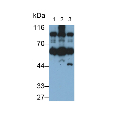 Hexokinase 1 (HK1) Human Monoclonal Antibody