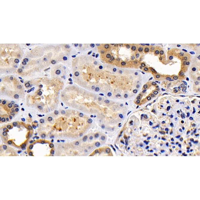 B-Cell Leukemia/Lymphoma 2 (Bcl2) Human Monoclonal Antibody