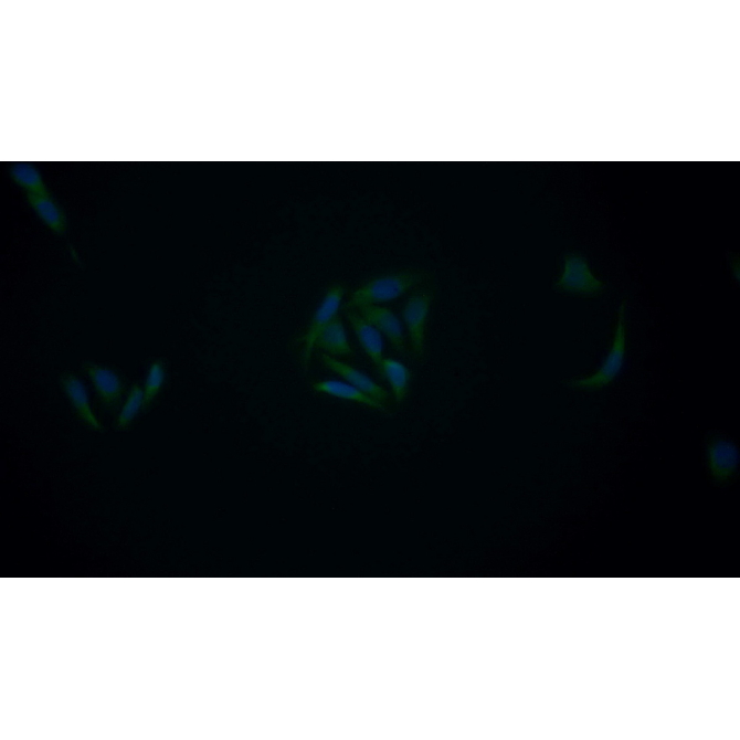 B-Cell Leukemia/Lymphoma 2 (Bcl2) Human Monoclonal Antibody