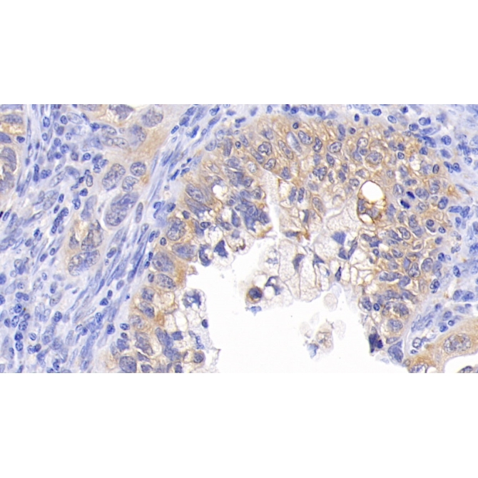 B-Cell Leukemia/Lymphoma 2 (Bcl2) Human Monoclonal Antibody