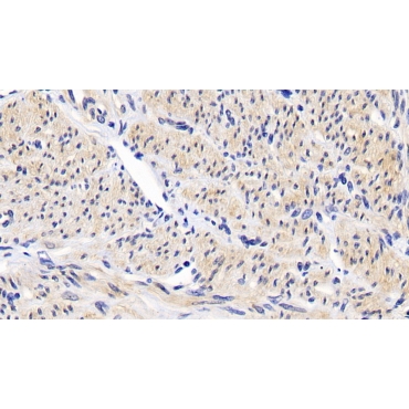 B-Cell Leukemia/Lymphoma 2 (Bcl2) Human Monoclonal Antibody