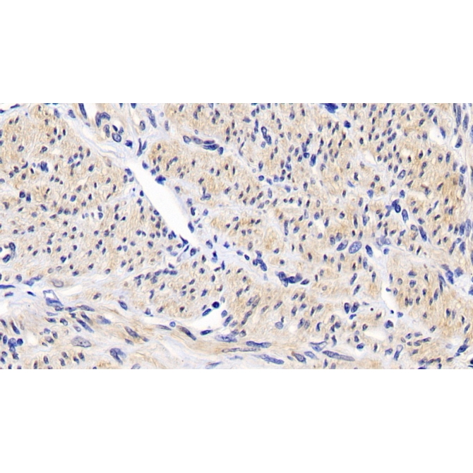 B-Cell Leukemia/Lymphoma 2 (Bcl2) Human Monoclonal Antibody